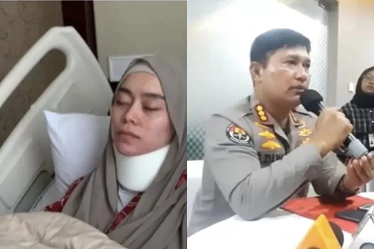 Hasil Visum Lesti Kejora Ada Beberapa Gangguan Fungsi Bagian Tubuh