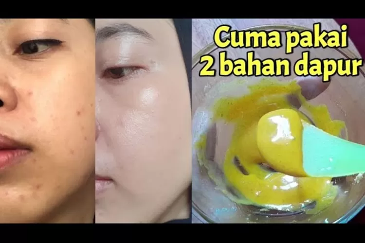 Tak Disangka Pakai Masker Susu Dancow Dicampur Bubuk Kunyit Buat Wajah