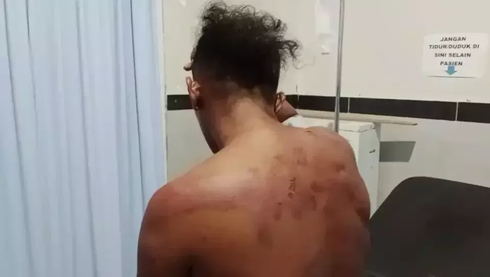 Sugandi, wartawan online menjadi korban penganiayaan  yang diduga dilakukan dua oknum TNI AL di Provinsi Maluku Utara. foto: int