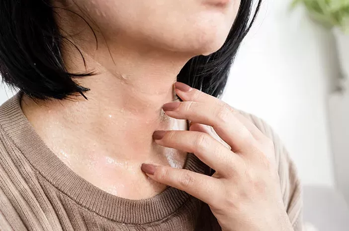 Keringat dingin umumnya timbul saat sedang gugup, namun,juga bisa jadi tanda penyakit tertentu dalam tubuh. Misalnya seperti syok, migrain, vertigo, dan sepsis.(Sumber:Pixabay/Pexels)