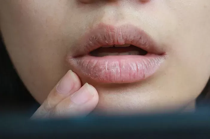 Ciri-ciri tubuh kekurangan vitamin B2. (Sumber:Pixabay/Silvia)