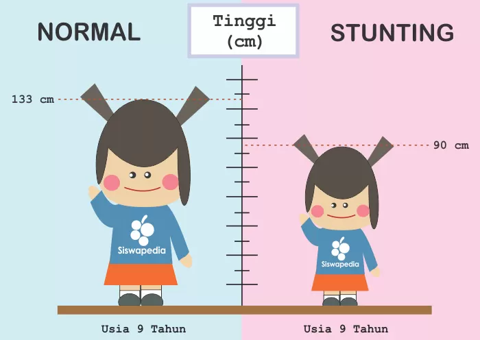 Kenali Ciri-Ciri Dan Penyebab Stunting Pada Anak - Akurat