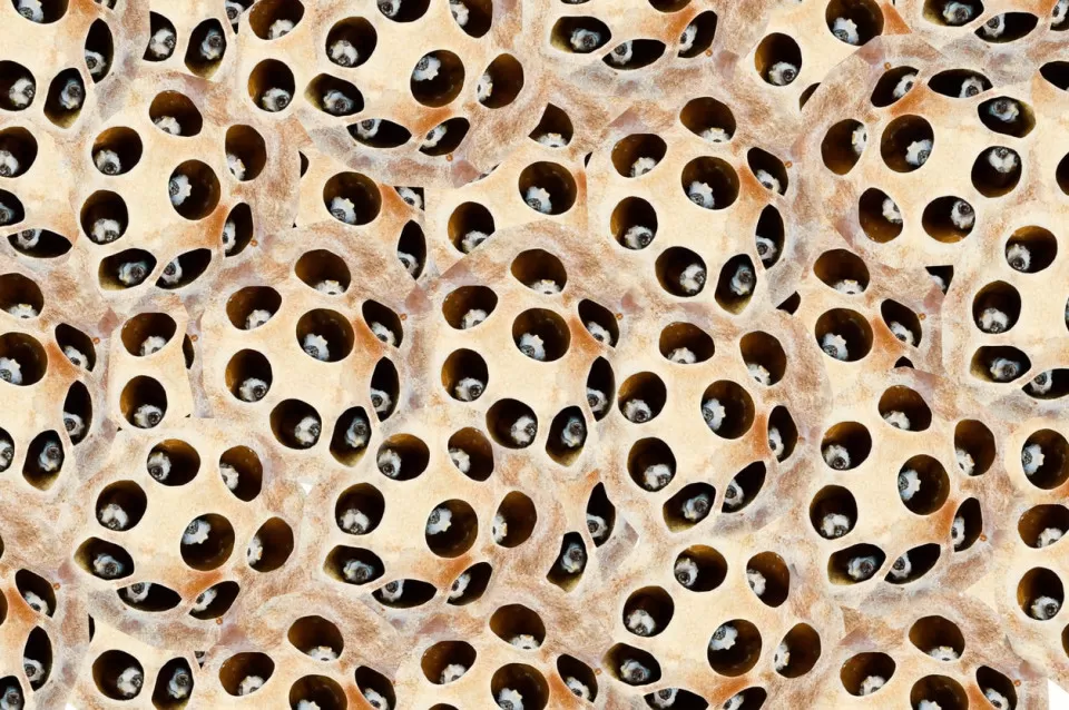 trypophobia test