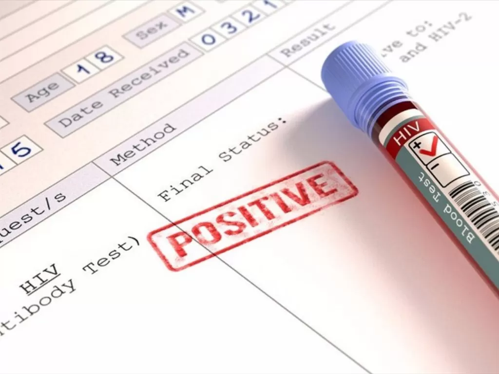 Ilustrasi hasil test HIV. (mymed.com)