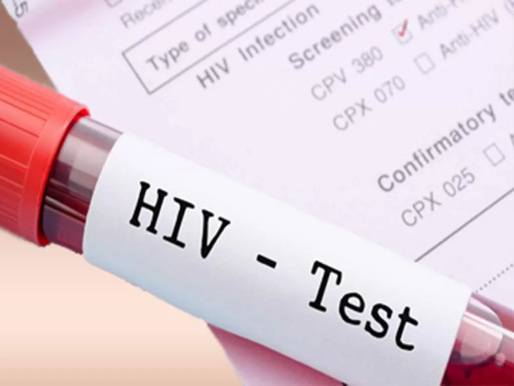 Ilustrasi hasil test HIV. (iprexnews.com)
