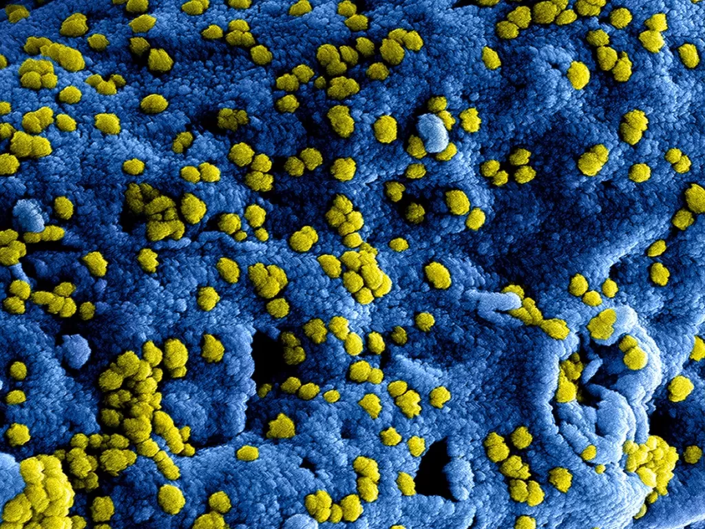 Ilustrasi virus korona (Unsplash/CDC)