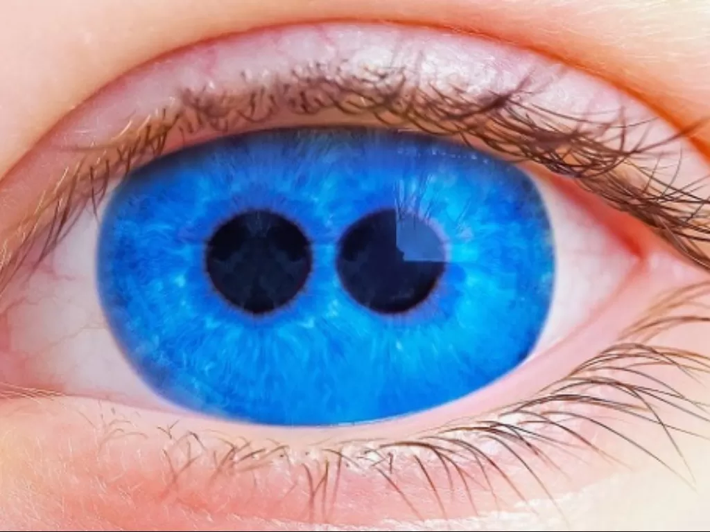  Ilustrasi mata dengan kelainan genetik (voicetube.com)