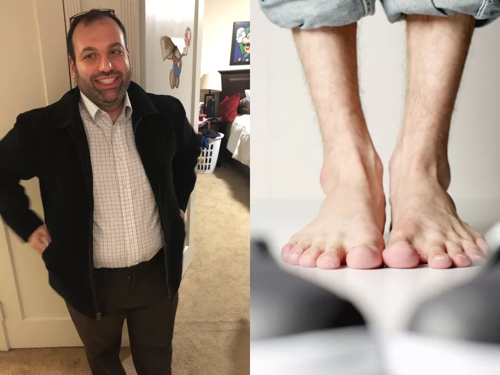Kiri: Pria yang panik karena kakinya membiru (Twitter/@MShrayber) / Kanan: Ilustrasi kaki membiru (pixnio)