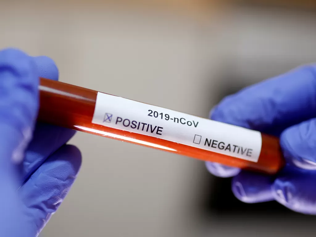 Ilustrasi test tube dengan label positif virus korona (photo/REUTERS/Dado Ruvic)
