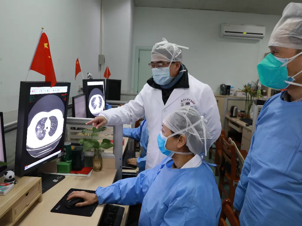  Petugas medis memeriksa CT scan (computed tomography) dari seorang pasien di Rumah Sakit Zhongnan, Universitas Wuhan setelah wabah virus corona baru di Wuhan (China Daily)
