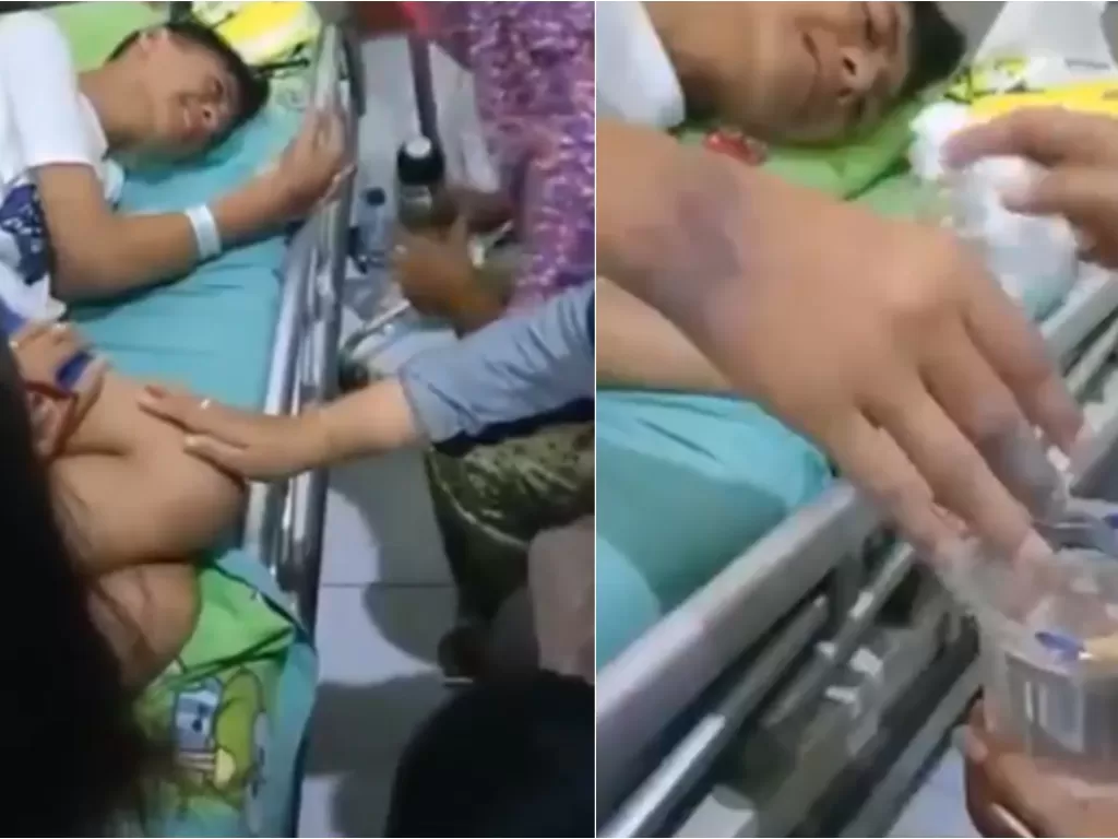 Potret siswa korban perundungan menahan sakit karena jari tengahnya bengkak (Twitter/@black__valley1)