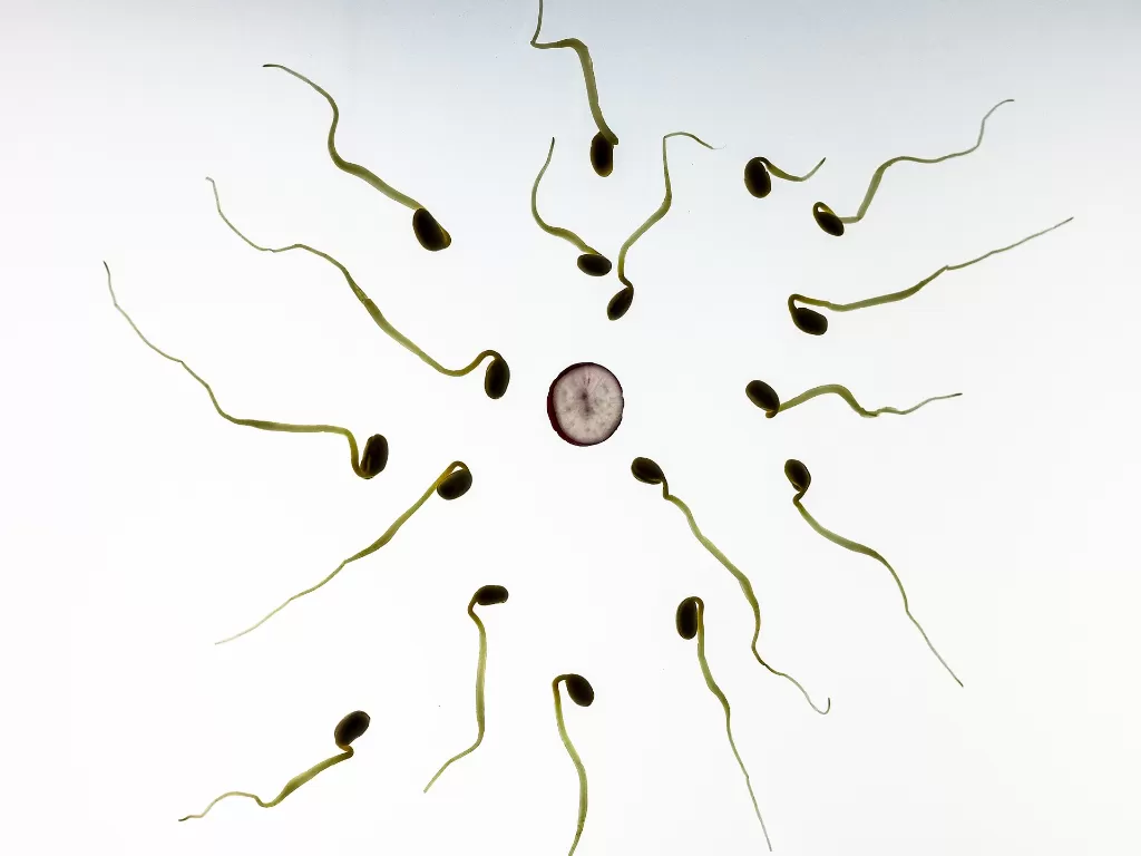 Ilustrasi sperma (Pixabay/Thomas Breher)