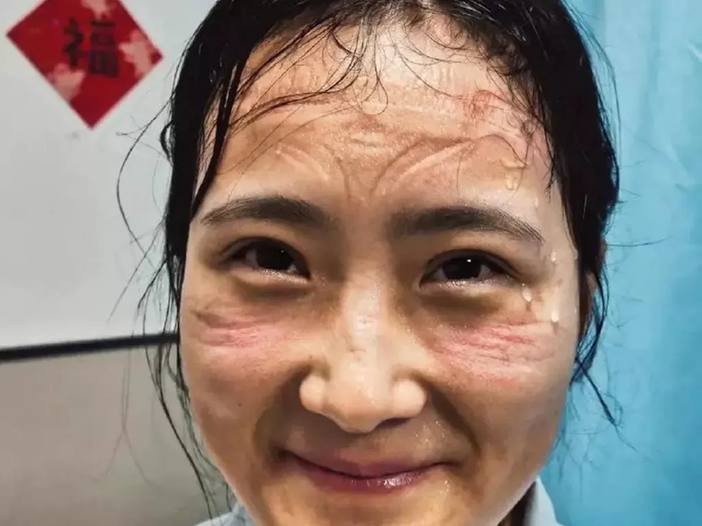 Potret wajah perawat korban virus korona di Tiongkok. (photo/asiaone)