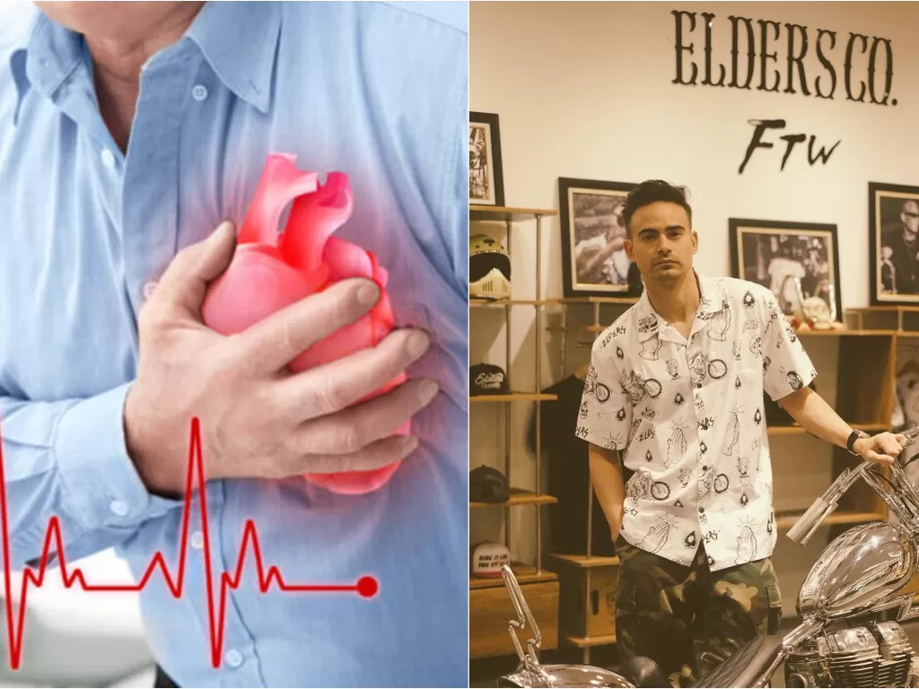 Kiri: ilustrasi orang mengalami gangguan jantung (Parys Gazette). Kanan: Ashraf Sinclair yang meninggal karena serangan jantung (instagram/@ashrafsinclair)