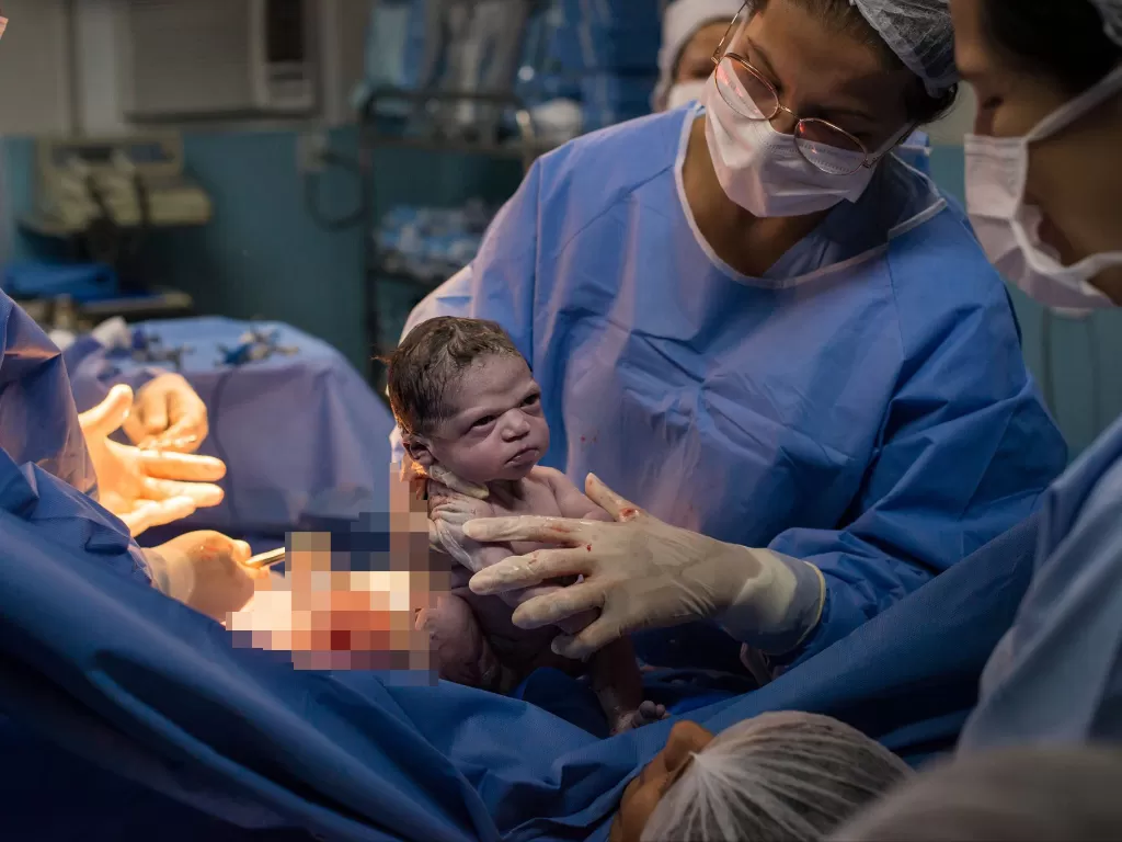 Bayi yang lahir dengan wajah cemberut. (photo/Facebook/Rodrigo Kunstmann Fotógrafo Profissional)