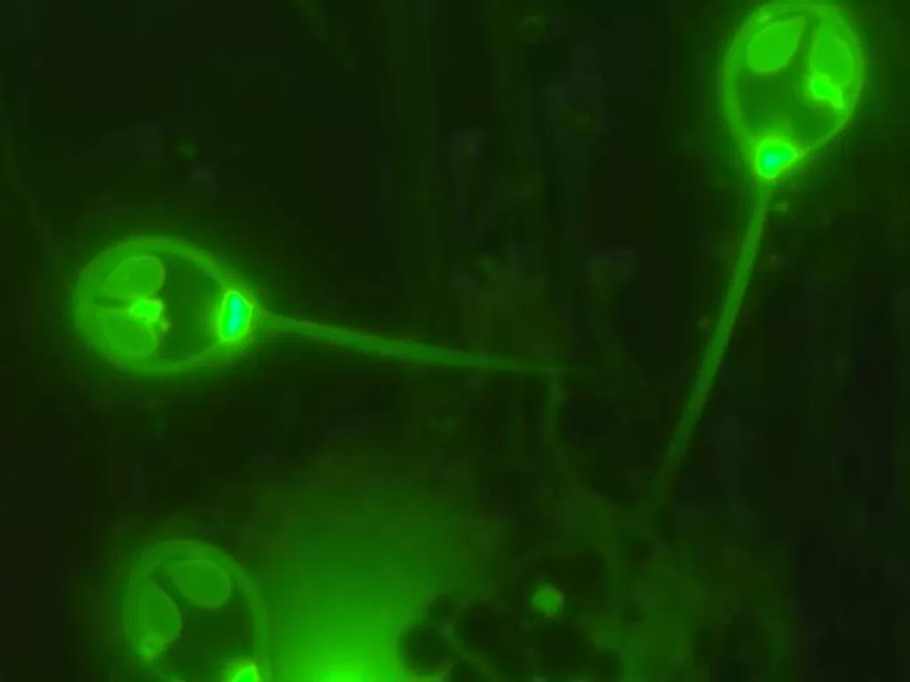Nuklues dalam H. salminicola berwarna hijau ketika dilihat lewat mikroskop berpijar  (phys.org)