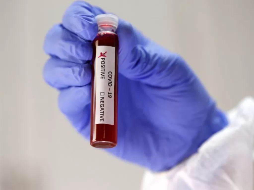 Ilustrasi pengujian sampel darah suspek virus corona. (REUTERS/Dado Ruvic)
