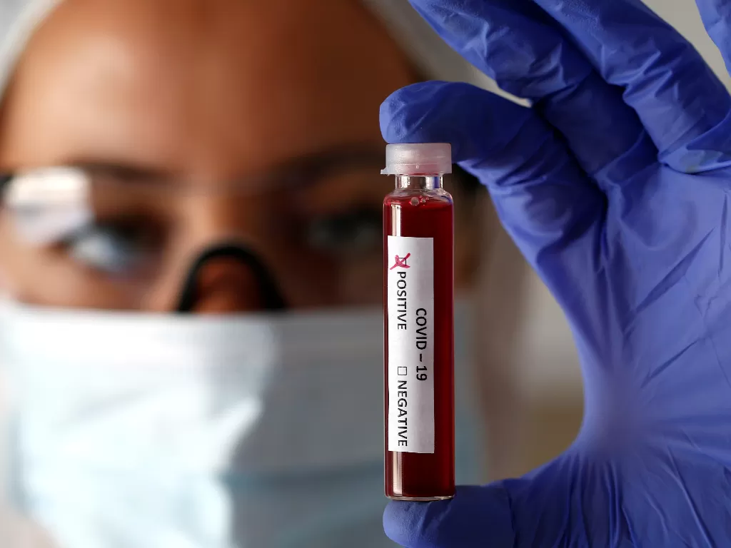 Ilustrasi petugas medis menunjukkan hasil tes darah pasien positif corona. (REUTERS/Dado Ruvic)