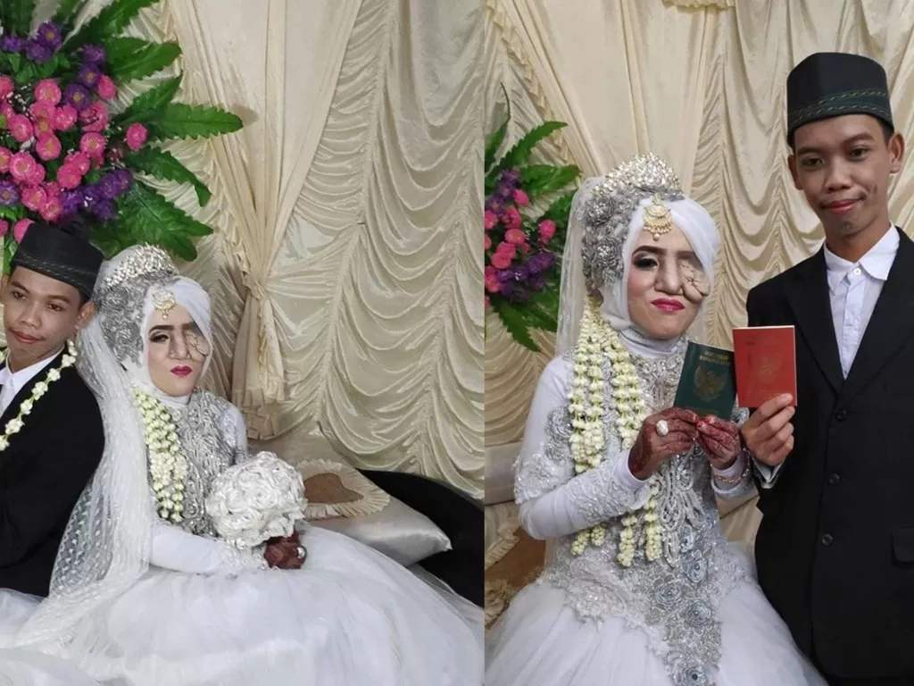 Pria di Pekalongan menikahi kekasihnya yang memiliki kelainan wajah. (Facebook/Wong Paling Sabar Dewe)