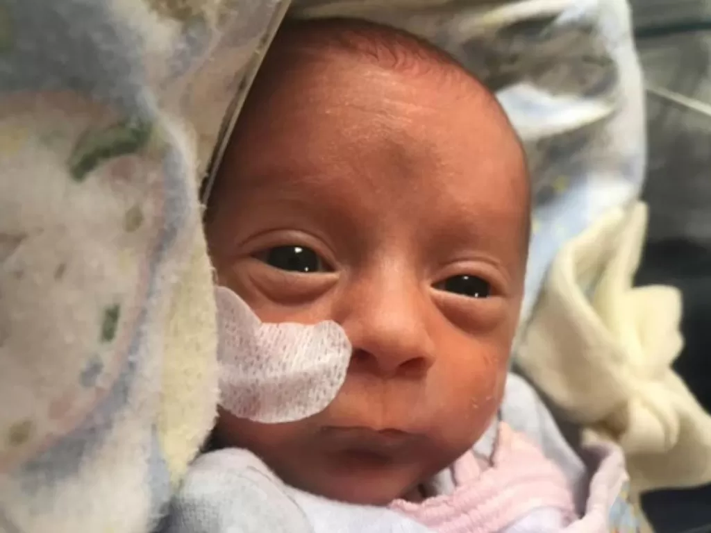 Bayi prematur positif corona berhasil sembuh (nypost.com)