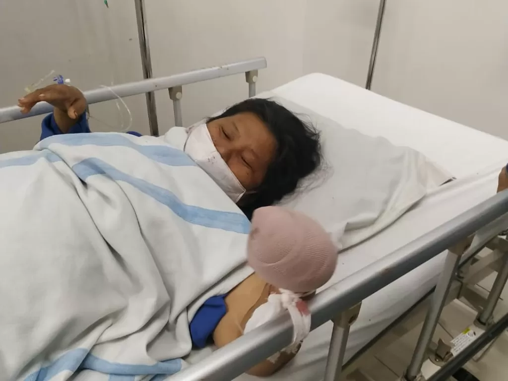 Erdina br Sihombing korban begal saat dirawat di rumah sakit Murni Teguh, Medan, Jumat (1/5/2020)