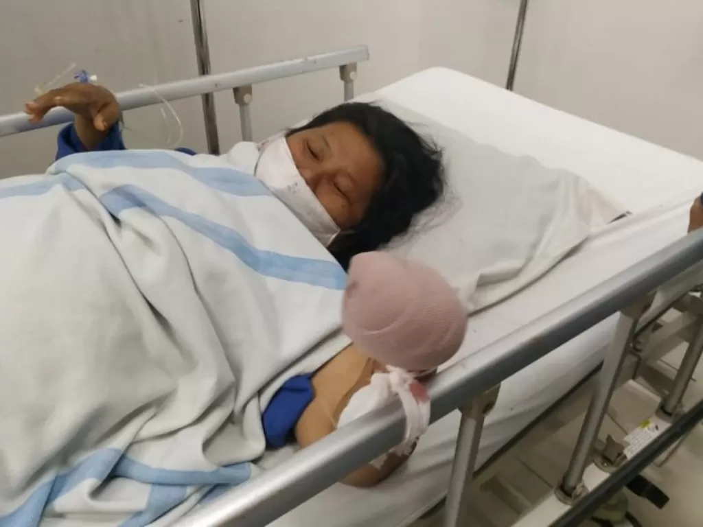 Erdina Sihombing saat dirawat di rumah sakit setelah empat jarinya putus awal Mei lalu (Istimewa)