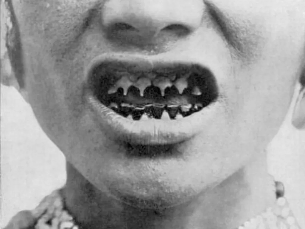 Ilustrasi meruncingkan gigi suku Bagobo. (Ilustrasi/world4.eu)