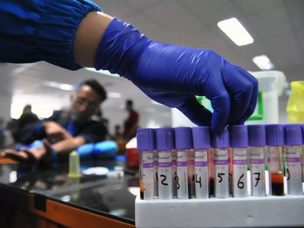 Ilustrasi sampel darah rapid test Covid-19 (ANTARA FOTO/Arif Firmansyah)