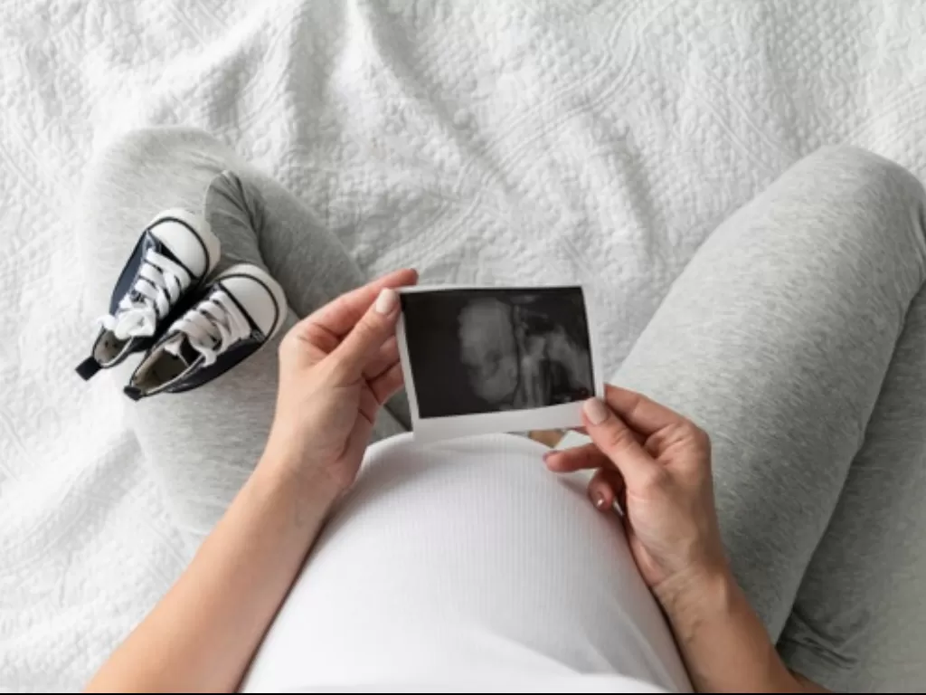 Wanita hamil memegang hasil ultrasound dari dokter.(freepik)
