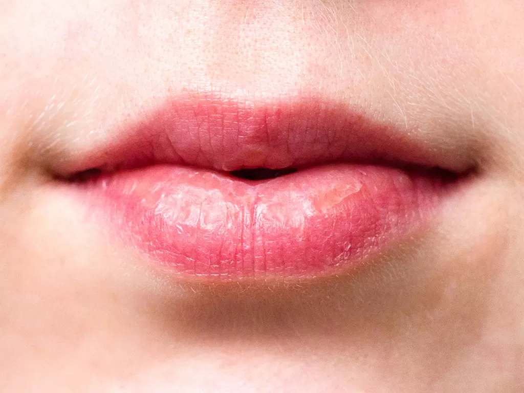Bibir biru gejala baru virus corona (Pixabay/Anemone123)