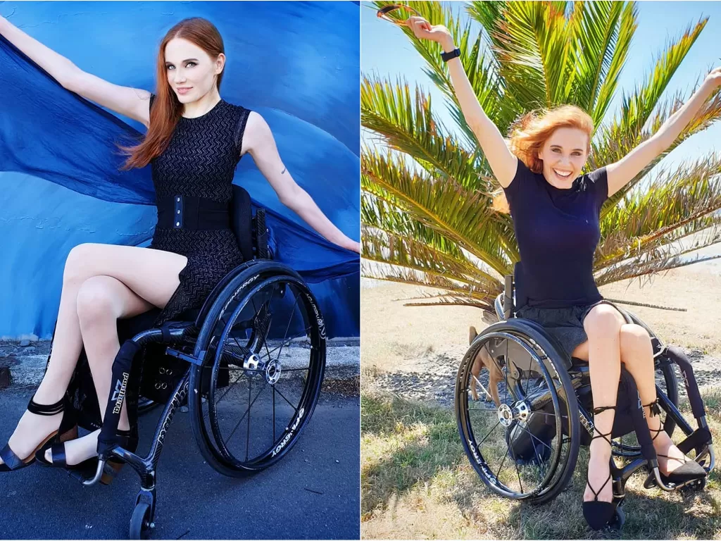 Claire Freeman, model berkursi roda. (instagram/@claire.freeman.nz)