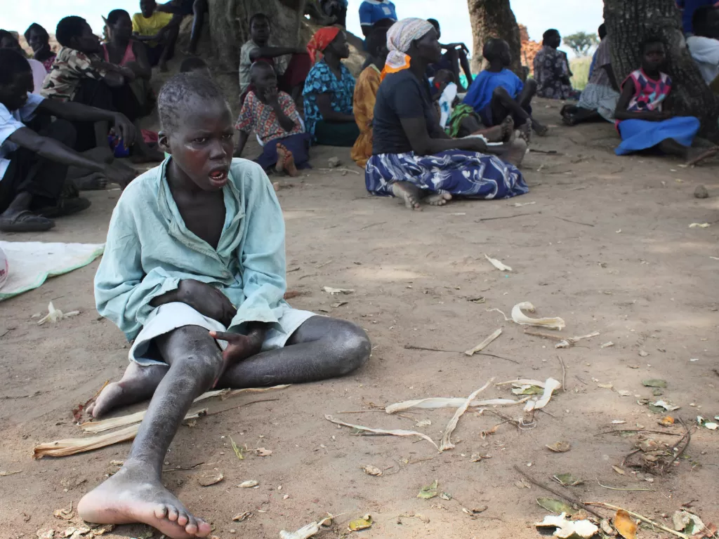 Seorang anak dengan sindrom mengangguk yang menunggu pengobatan di distrik Pader Uganda. (npr.org/Matthew Kielty)