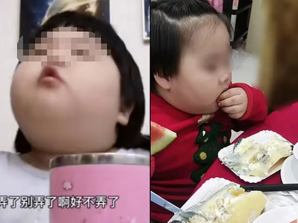 Bocah dipaksa makan banyak oleh orangtuanya. (Dailymail)