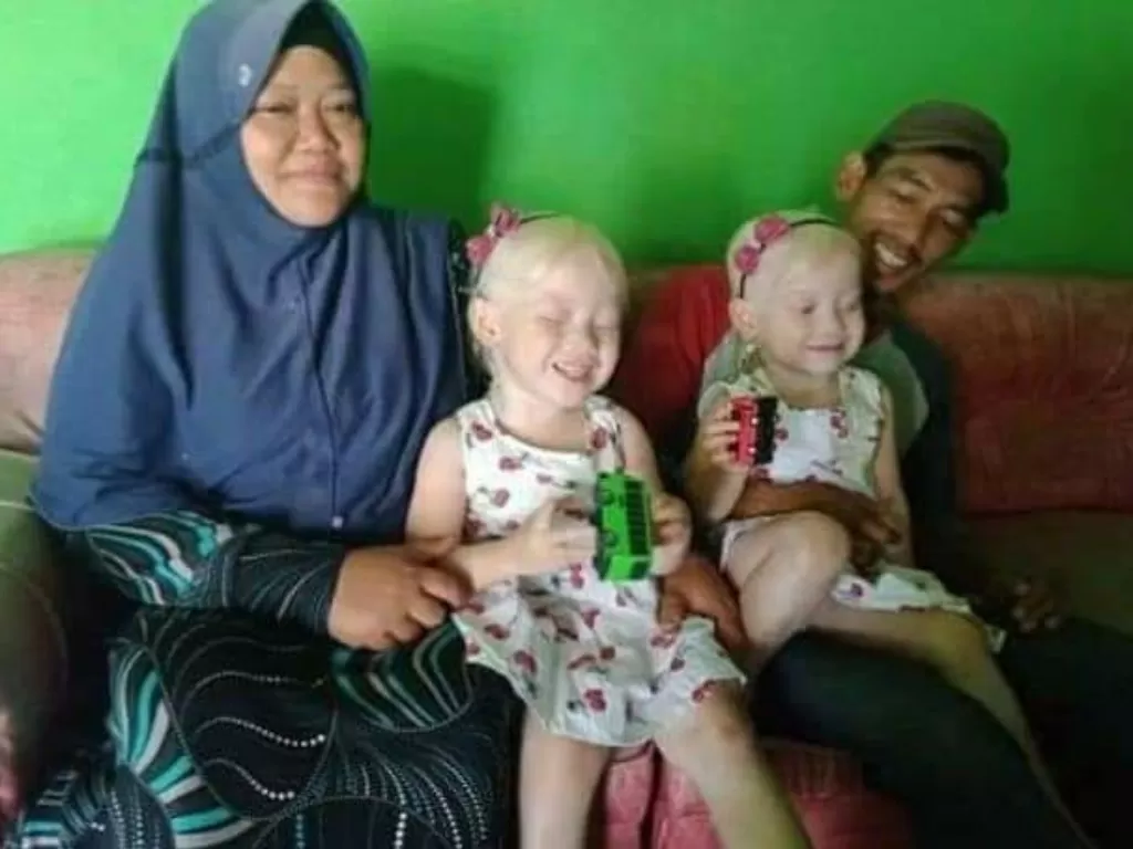 Pasutri Nunung Kristanto (44 tahun) dan Suratmi (35 tahun) punya anak kembar albino. (Istimewa)