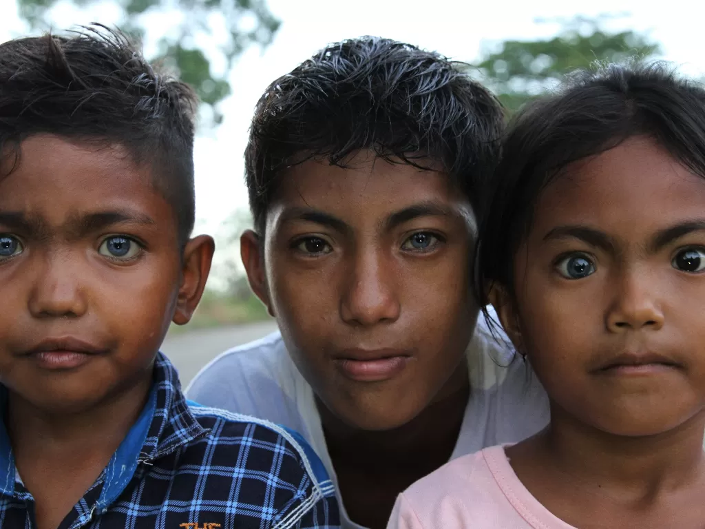 Fardan Ramadan (kiri), Syawal (tengah) dan Eni Wahyuni (kanan) menunjukkan bola mata berwarna biru dan kemerahan di Kendari, Sulawesi Tenggara (ANTARA FOTO/Jojon)