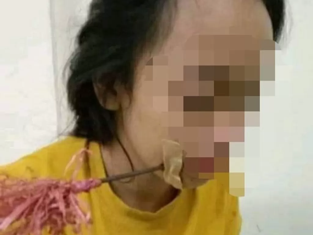 Wanita muda terkena busur panah di Makassar. (Instagram)