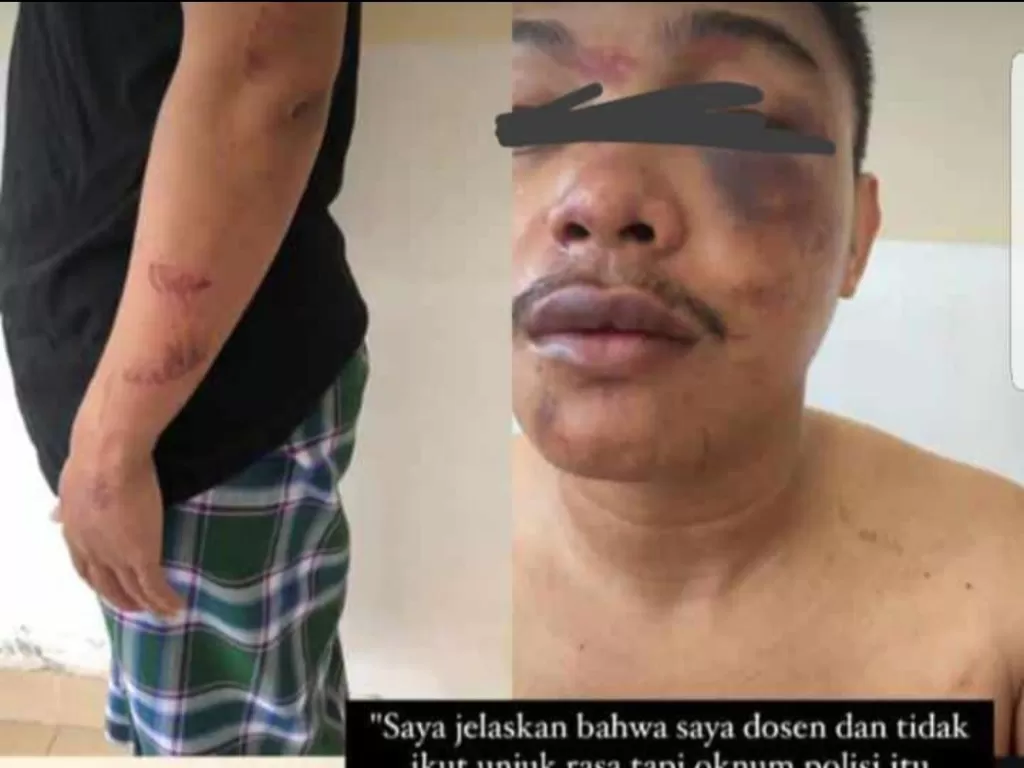 Dosen di Makassar diduga dipukuli oknum aparat (Twitter/@PBHI_Nasional)