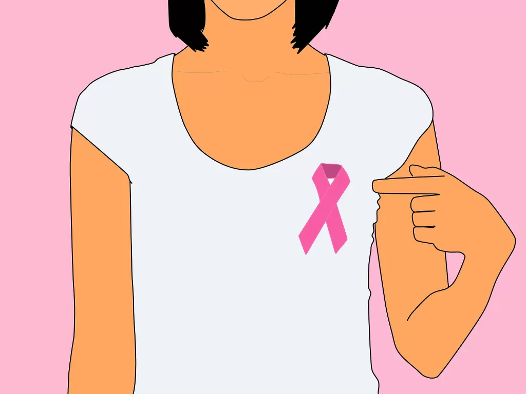 Ilustrasi kanker payudara (Pixabay/Waldryano)