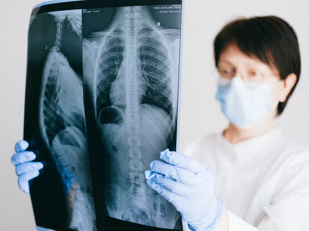 Ilustrasi kerusakan paru-paru (Pexels/Anna Shvets)