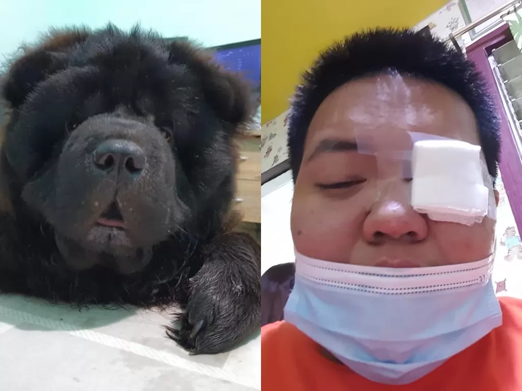 Anjing yang ngecek kondisi majikannya tiap jam, usai matanya terluka (Facebook/Icho Song)