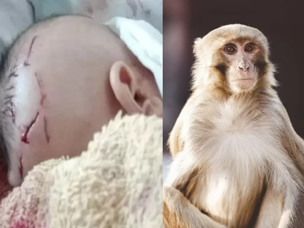 Bayi dua bulan yang diserang monyet (Harian Metro/freepik)