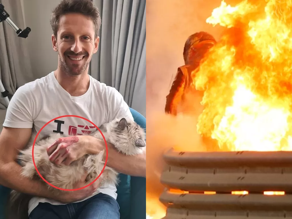 Kiri: Romain Grosjean dengan luka bakar. (Photo/Instagram/@grosjeanromain) Kanan: Detik-detik Romain Grosjean keluar dari kobaran api. (Photo/Daily Star)