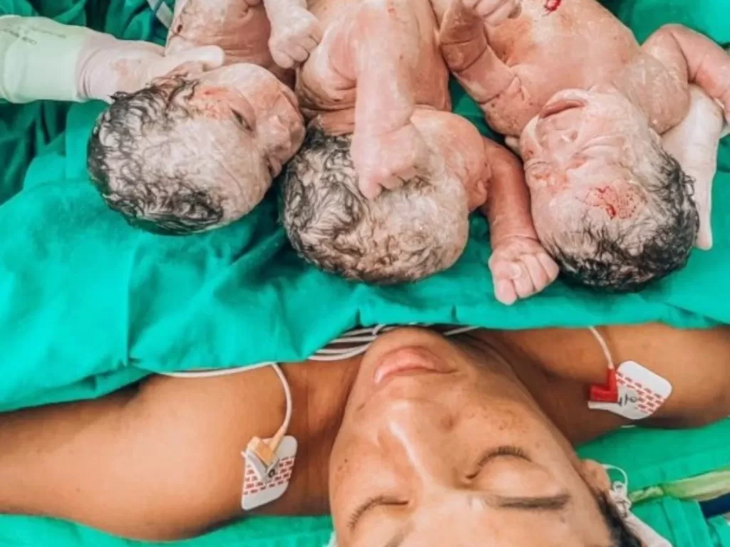 Ibu yang melahirkan anak kembar tiga meninggal setelah alami pendarahan (The Sun)