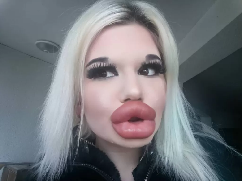 Wanita pemilik bibir terbesar (Instagram/@andrea.andrea345)