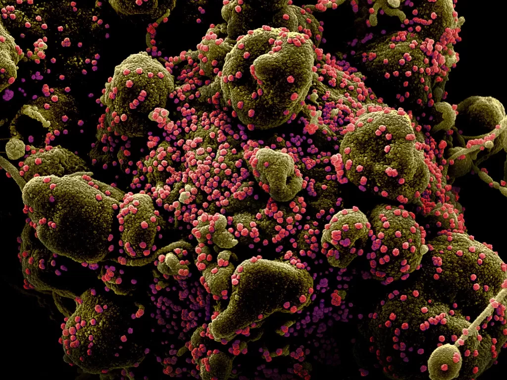 Ilustrasi virus (NIH/Handout via REUTERS)