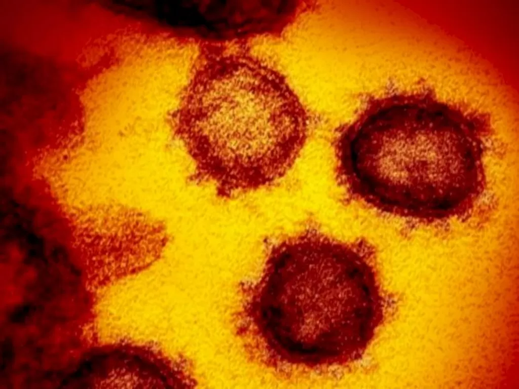 Virus corona di permukaan sel manusia. (NIAID-RML)