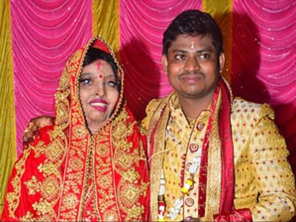 Pria india yang nikahi wanita cacat (Caters News)