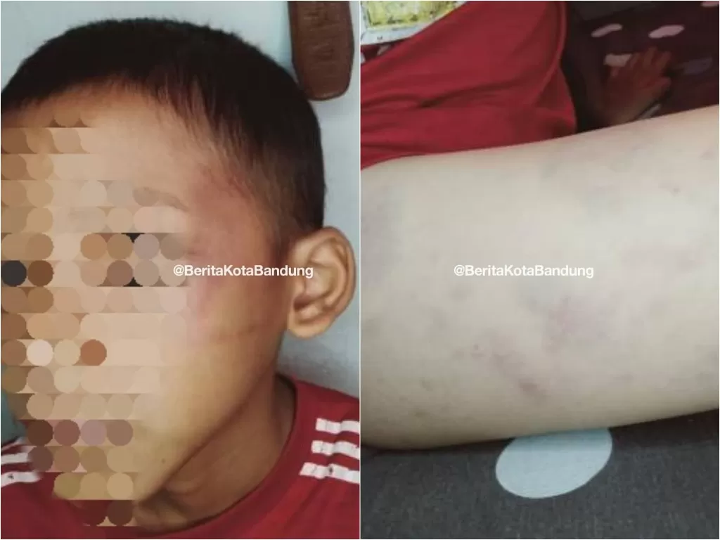 Ayah siksa anak sendiri di Bandung (Instagram/beritakotabandung)