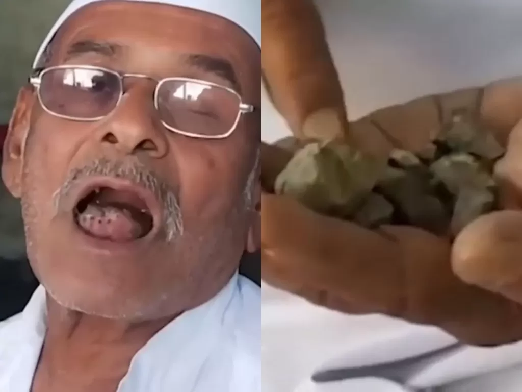 Pria ini makan batu selama 32 tahun. (Photo/YouTube/Dhinchak khabare)