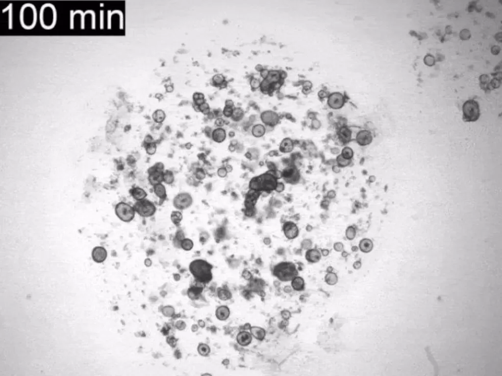 Tampilan sel organoid yang menangis. (photo/Dok. Science Alert)